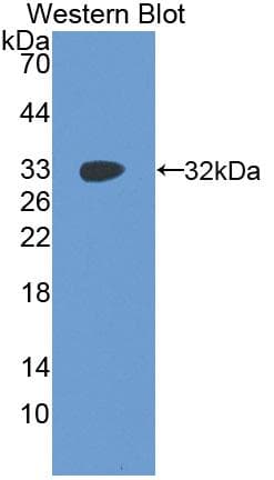 IGF2BP2 Antibody (aa141-384, Biotin)
