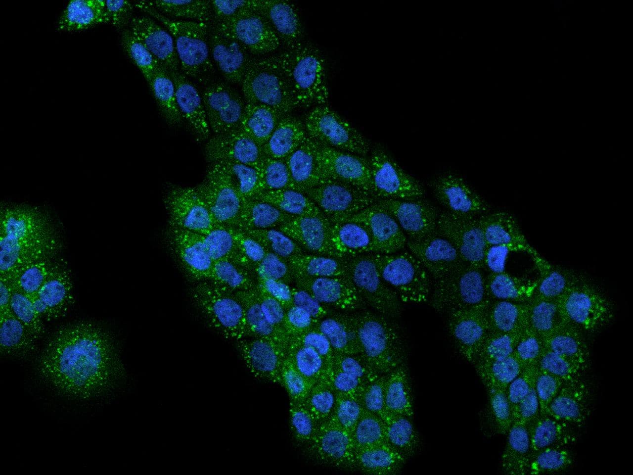Polyclonal Rabbit anti-Human PLIN3 / M6PRBP1 / TIP47 Antibody (IF)