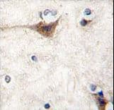 CDH10 / Cadherin 10 Antibody (aa25-55)