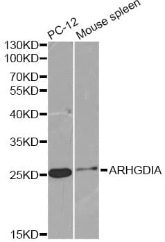 ARHGDIA / RHOGDI Antibody
