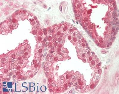 IHC-plus™ PARK7 / DJ-1 Antibody (aa 1-188)