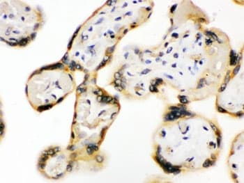 UPF3B Antibody