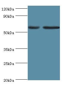 DGKE / DGK Epsilon Antibody (aa40-260)