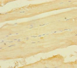 Polyclonal Rabbit anti-Human TNFAIP6 / TSG-6 Antibody