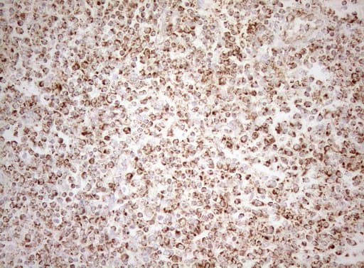 DECR1 Antibody (clone OTI5D12)