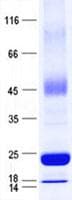Human NDUFA8 Protein (Recombinant His, N-Terminal)