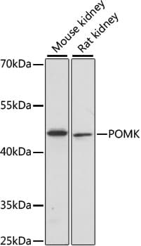 POMK / SGK196 Antibody