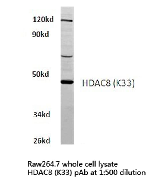 Polyclonal Rabbit anti-Human HDAC8 Antibody (Lys33, IHC, WB)