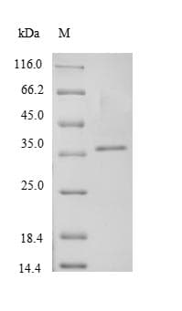 Staphylococcus aureus clfA Protein (Recombinant)