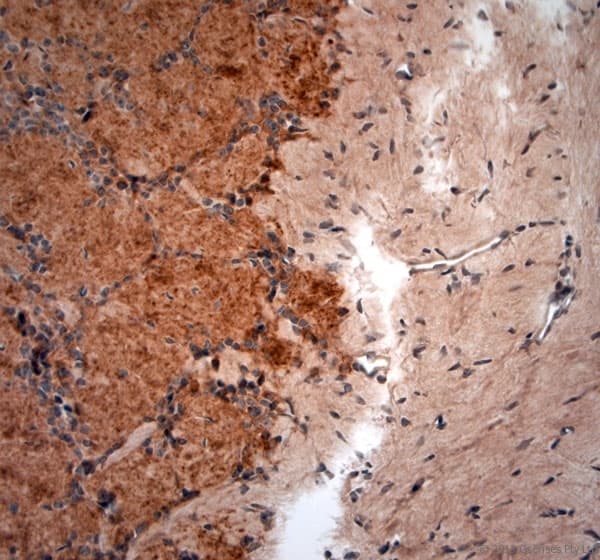 GAD 65+67 Antibody (aa530-600)