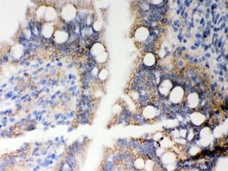 HLA-A Antibody