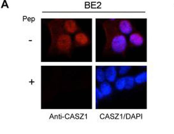 CASZ1 Antibody