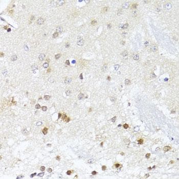 Polyclonal Rabbit anti-Human EGLN1 + EGLN2 Antibody (IHC)
