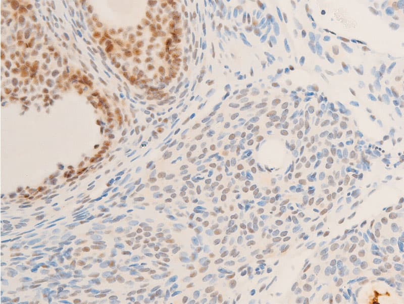 NR3C1/Glucocorticoid Receptor Antibody (phospho-Ser226)