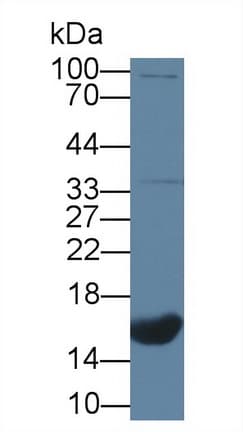 NPPC Antibody (aa33-125)