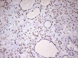 DDX56 Antibody (aa323-547, clone OTI2E5)