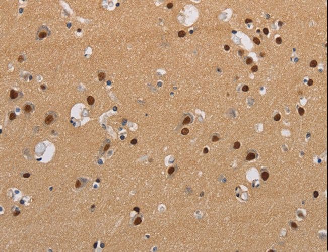 KV6.4 / KCNG4 Antibody