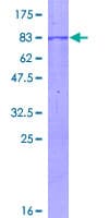 Human CHKA / CK / Choline Kinase Protein (Recombinant GST)