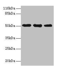 Polyclonal Rabbit anti-Human KRT38 / Keratin 38 / KRTHA8 Antibody (aa2-456, WB)