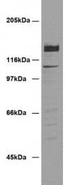 DSG2 / Desmoglein 2 Antibody (clone 7H9)