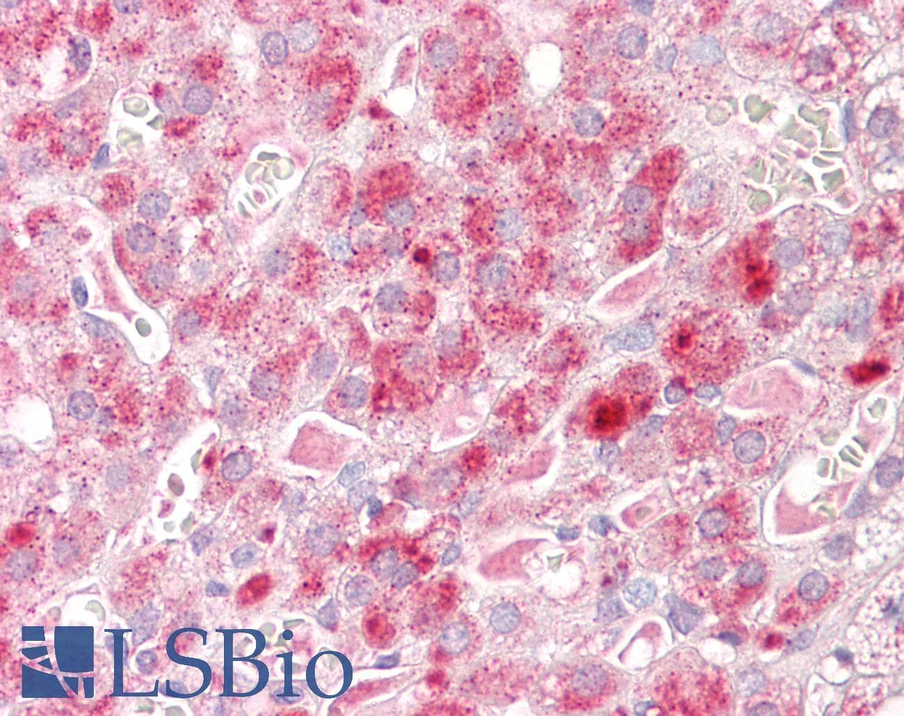 IHC-plus™ MAP2K1 / MKK1 / MEK1 Antibody (aa264-313)