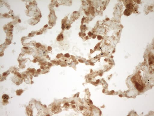 PRMT5 Antibody (aa238-499, clone OTI2C12)