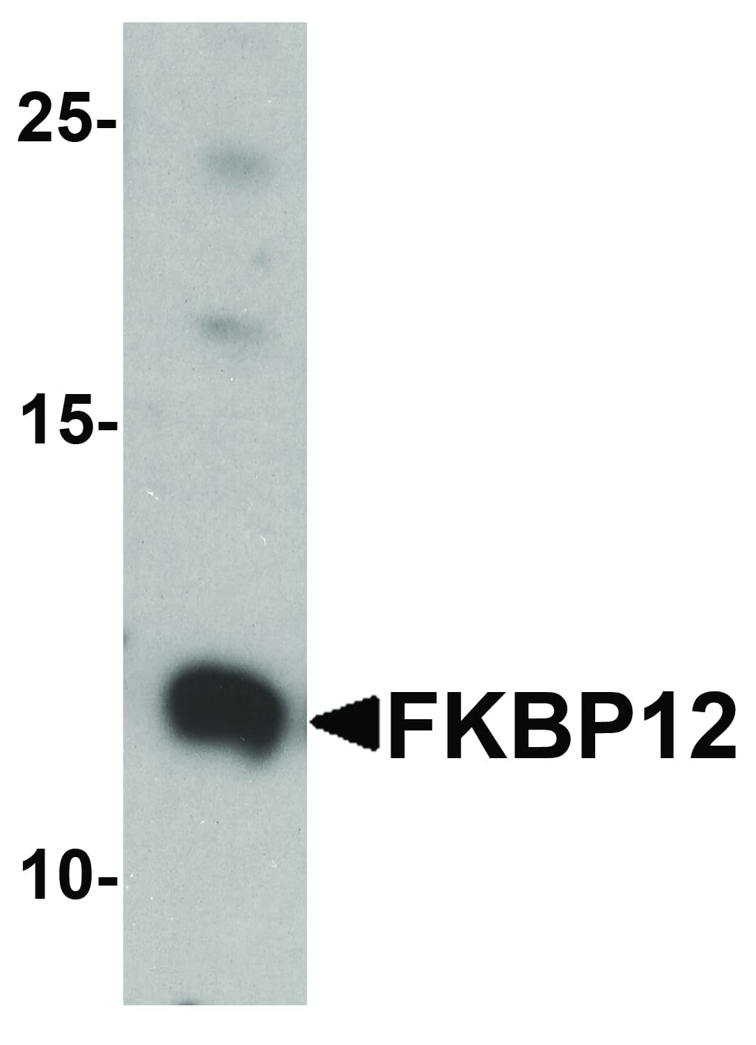 Polyclonal Rabbit anti-Human FKBP1A / FKBP12 Antibody (IF, WB)