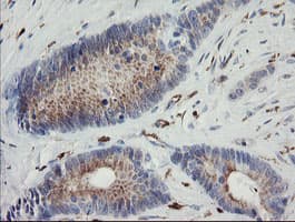 PHKG2 Antibody (aa1-216, clone OTI1F9)