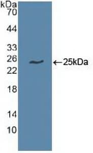 UBCH10 / UBE2C Antibody (aa2-179, Biotin)