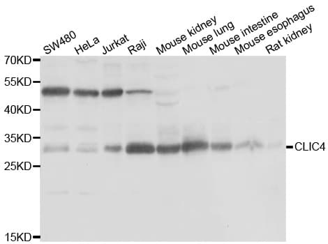 Polyclonal Rabbit anti-Human CLIC4 Antibody (IHC, IF, WB)