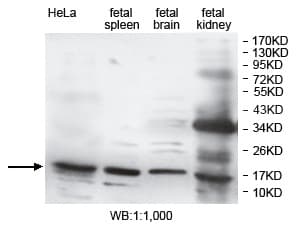 DUSP3 / VHR Antibody (aa2-144)