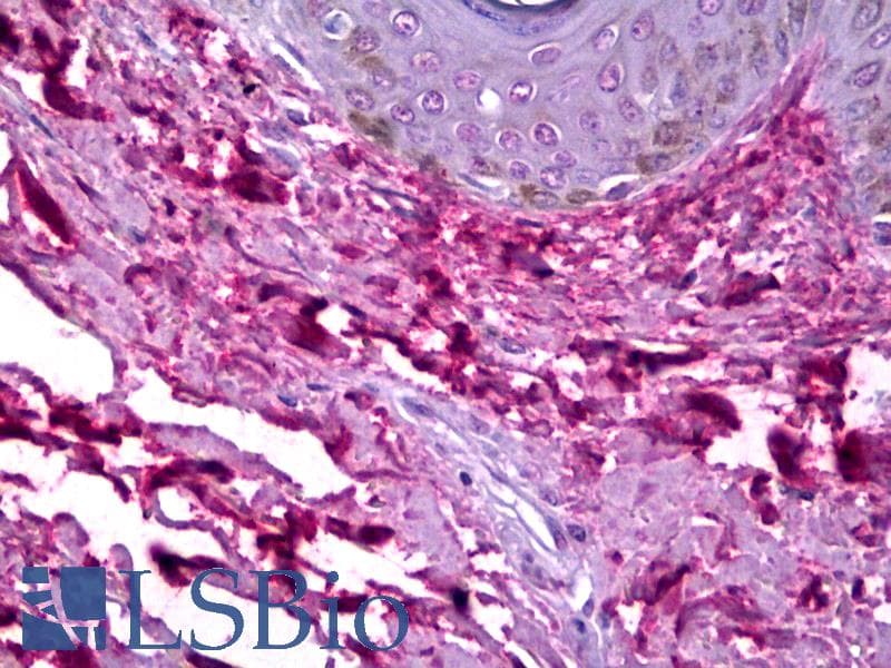 IHC-plus™ Collagen I Antibody (clone COL-1)