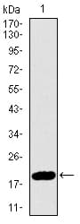 Monoclonal Mouse anti-Human p16INK4a / CDKN2A Antibody (clone 1D7D2, IHC, WB)