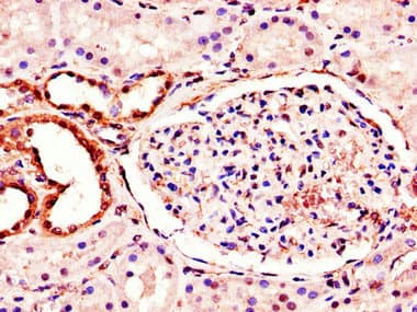 Polyclonal Rabbit anti-Human MT-ND1 Antibody (aa23-67, IHC, WB)