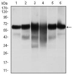 PathPlus™ KRT5 / CK5 / Cytokeratin 5 Antibody (aa158-272, clone 2C2)