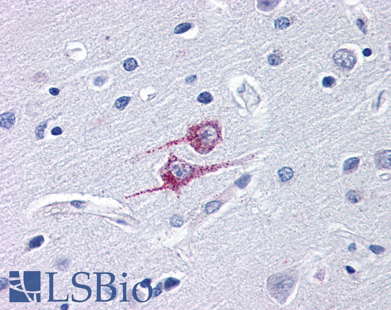 IHC-plus™ Polyclonal Rabbit anti-Human TRIM25 Antibody (IHC, IF, WB)