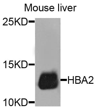 Polyclonal Rabbit anti-Human HBA1+2 / Hemoglobin Alpha Antibody (IHC, WB)
