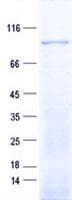 Human PDE6A / PDE6 Alpha Protein (Recombinant His, N-Terminal)