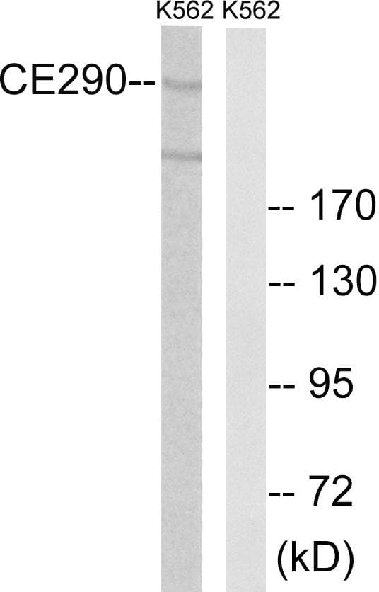 CEP290 Antibody