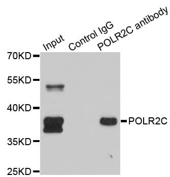 Polyclonal Rabbit anti-Human POLR2C Antibody (IHC, WB)
