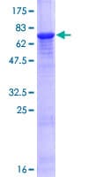 Human KRT34 / Keratin 34 / KRTHA4 Protein (Recombinant GST)