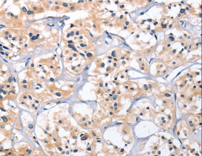 Polyclonal Rabbit anti-Human CEP97 Antibody (IHC, WB)
