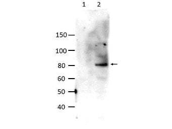 STAT6 Antibody (phospho-Tyr641)