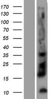 KLK12 / Kallikrein 12 Protein (Over-Expression Lysate Myc-DDK (Flag))