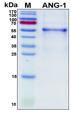 Mouse ANGPT1 / Angiopoietin-1 Protein (Recombinant His, N-Terminal)