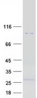 Human RHBDF1 Protein (Recombinant Myc-DDK (Flag))
