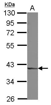 Polyclonal Rabbit anti-Human DCPS Antibody (IHC, WB)