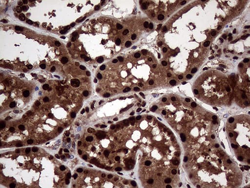 TALDO1 / Transaldolase 1 Antibody (clone OTI2E4)
