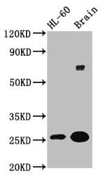 FEV / PET1 Antibody