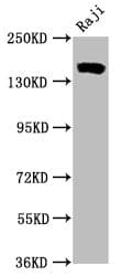 Recombinant Monoclonal Rabbit anti-Human CR2 / CD21 Antibody (IHC, IF, WB)